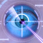Mittels Laser werden Sehfehler im Auge korrigiert